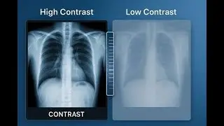 Contrast radiography; diagnostic imaging technique, contrast medium radiopaque or radiolucent