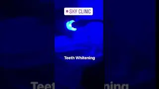 TEETH WHITENING SKY CLINIC BIRMINGHAM