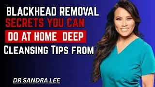 Blackhead Removal Secrets You Can Do at Home | Deep Cleansing Tips from [Dr. Sandra Lee]