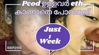 ✨Pimple Free Face ✨ Simple Pack At Home 🫰😍#viralfacepack 