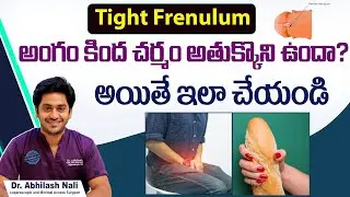 Tight Frenulum Causes Symptoms and Treatment in Telugu | How to Get Rid Tight Frenulum | Dr Abhilash