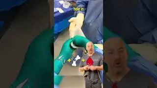 Double-Glove 🧤 🧤Orthopedics #shorts