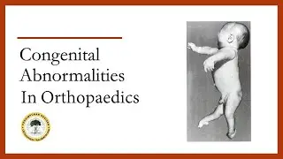 Chapter 8: Congenital Abnormalities In Orthopaedics (Part 1)