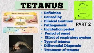 👉Tetanus Explained |🔹Types, Incubation Period, Treatment💉 & Differential Diagnosis | Medical Lecture
