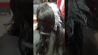 Hair dandruff Treatment in winter season ✨👍
