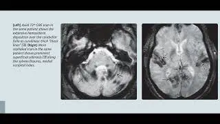 BRAIN DIAGNOSTIC IMAGING BOOK IMAGES ONLY &lrm;@ctisus&nbsp; (2)