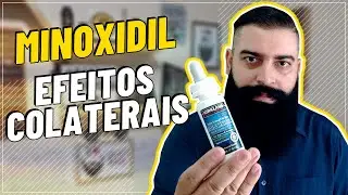 MINOXIDIL - EFEITOS COLATERAIS I O QUE SABER ANTES DE USAR I SAIBA QUAIS SÃO OS EFEITOS COLATERAIS