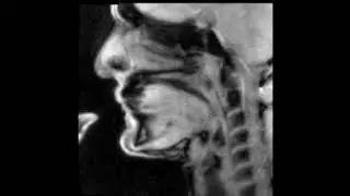 Douglas Yeo, trombone - MRI video 3 - articulated arpeggio
