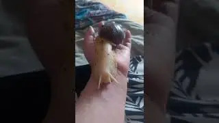 Snail therapy for scars