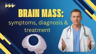 Brain Mass | MRI BRAIN !! Radiologist!! Radiology.