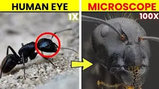 Normal Things That Look Shocking Under a Microscope 😱