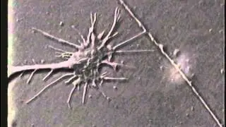 growth cone