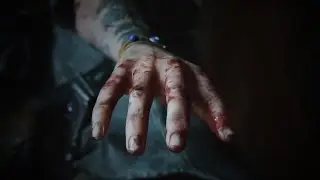Ellie's Trauma