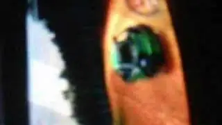 Asperger's - Invisible Tears (leddrain)