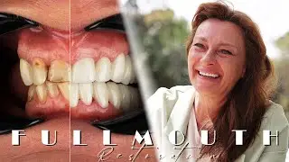 Full Mouth Restoration / Testimonial