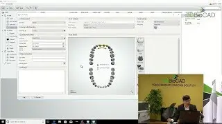 3DBioCAD - Digital Smile Design Pt.2 Model Builder for Mock-up