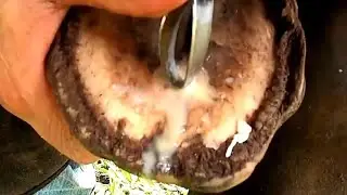 SAIU  e  Aliviou na Hora ..