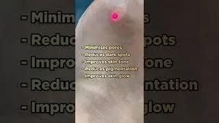 Carbon Laser | Laser face treatment | Carbon laser treatment | Skin glow treatment