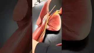 Nerve Arm Models