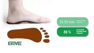 Ekovel Step Correct metod korekcije stopala