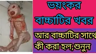 rampur hat hospital news | তুফানগঞ্জ হাসপাতালে জন্ম আজব বাচ্চা | Tufanganj dangerous baby is born