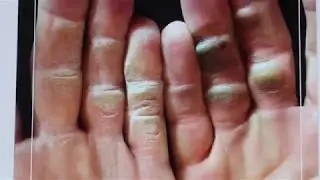 Ridiculously Calloused Hands