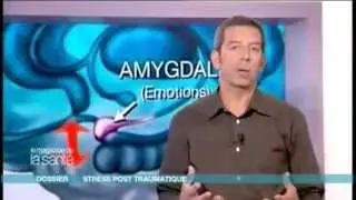 Stress post-traumatique