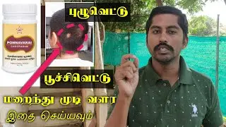 புழுவெட்டு குணமாக சிறந்த வழி | Alopecia Areata Hair Re-growth Natural Remedies | Next Day 360