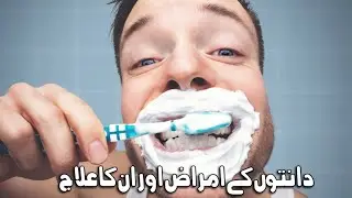 Problem Of Teeth And there Dasi Solution