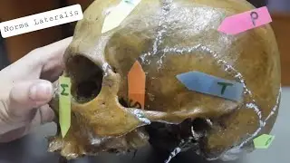 Norma Lateralis | Lateral view of skull