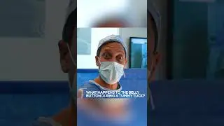 What happens to the belly button during a tummy tuck? #plasticsurgery #shorts #tummytuck #bbl