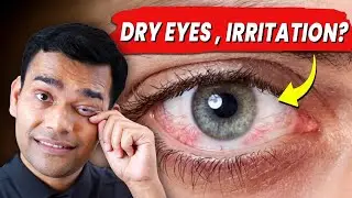 Natural Remedies For Dry Eyes , Irritation And Red Eyes - Dr. Vivek Joshi