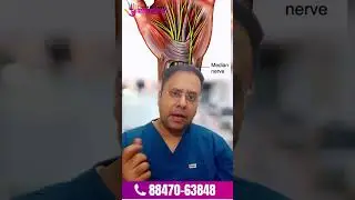 Carpal Tunnel Syndrome Surgery Explained | 2 Types of Carpal Tunnel Surgery | Chandigarh Hand Clinic