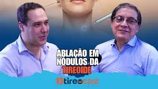 Tireocast Abratip | #Episódio28 - Ablação em Nódulos da Tireoide