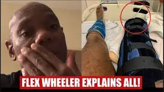 FLEX WHEELER EXPLAINS ALL!! (Reason For Amputated Leg)
