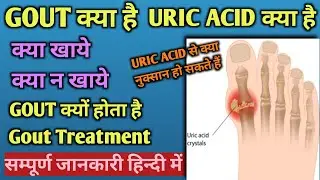 Uric Acid Kya Hota hai? Uric Acid Food, Symptoms, Treatment ll Gout and Uric Acid (Hindi)