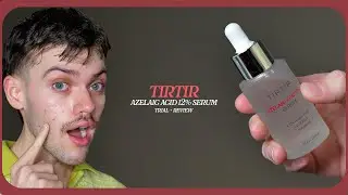 tirtir azelaic acid 12% serum | trial + review