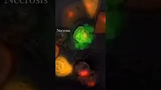 Nk Cell  