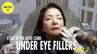 MY FIRST TIME TO TRY UNDER EYE FILLERS | CAT ARAMBULO-ANTONIO