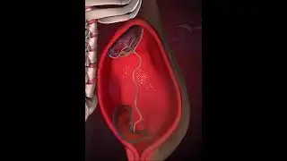 Precious fetus inside the womb ( 3D animation)