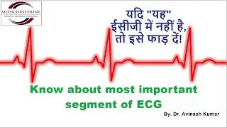 ECG Calibration | ECG Standardization Mark