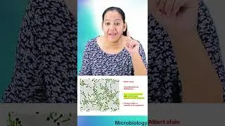 1 minute learning:  Corynebacterium diphtheriae  Chinese letter arrangement