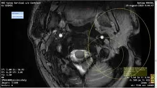 42. 2/2 St. Vincent's Primary Care / Northside Medical Associates (Complete Health) MRI Confusion