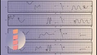 Nomi Epstein &mdash; Four Voices [w/ score]