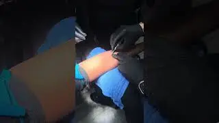 Стандартная внутривенная инъекция в стоматологической клинике Буллард.