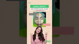 ZAP Photo Facial, Facial modern yang canggih, anti sakit, tanpa pencet, lamgsung glowing setelahnya