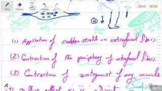 Mode of stimulation of stretch reflex (6-2016) by Dr Khaled A Abulfadle