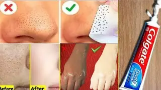 5 Amazing Beauty Hacks For Toothpaste || Colagte Hacks