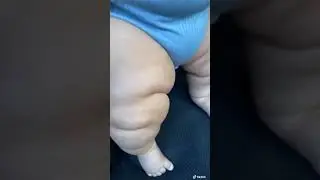 The fat baby