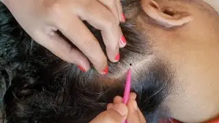Scalp Check ASMR: Sleep-Inducing Tingles